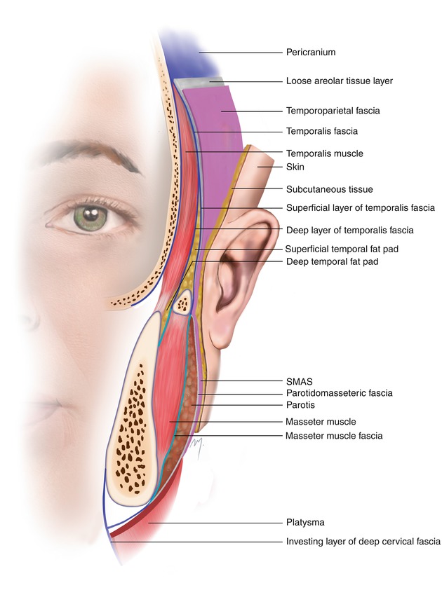 Scalp And Temple Plastic Surgery Key