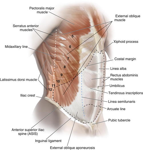 Abdominal Wall Anatomy and Vascular Supply | Plastic ...