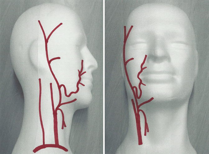 Functional Anatomy And Types Of Face Transplants Plastic Surgery Key