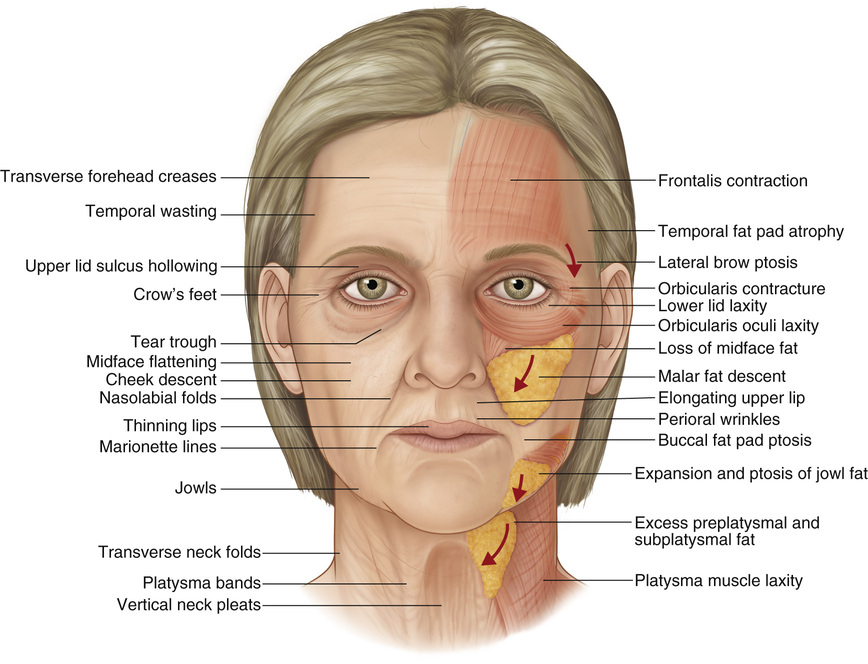 Pleasanton facial rejuvenation