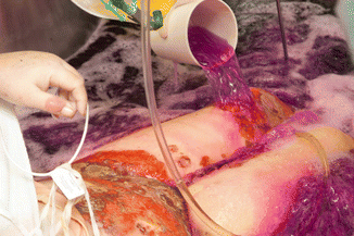 A270218_1_En_65_Fig4_HTML.gif