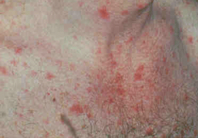 A125510_2_En_20_Fig2_HTML.gif