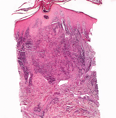 A324456_1_En_13_Fig11_HTML.gif