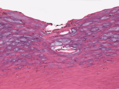 A324456_1_En_13_Fig7_HTML.jpg