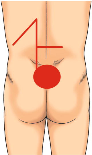 A332702_1_En_13_Fig2_HTML.jpg