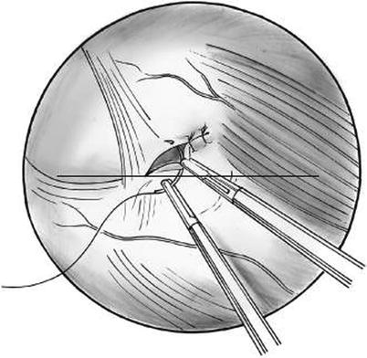 A151192_2_En_18_Fig3_HTML.jpg