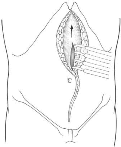 A151192_2_En_42_Fig2_HTML.gif