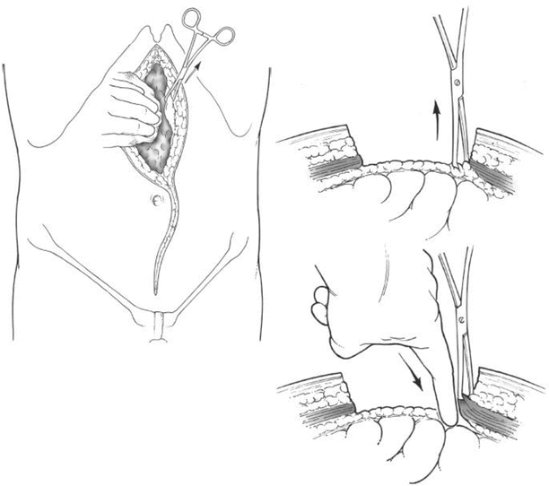 A151192_2_En_42_Fig3_HTML.gif