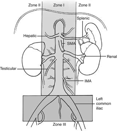 A151192_2_En_53_Fig1_HTML.jpg