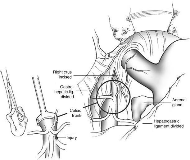 A151192_2_En_53_Fig2_HTML.jpg
