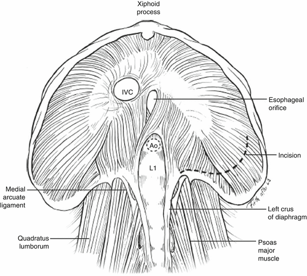 A151192_2_En_62_Fig2_HTML.gif