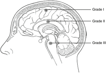 A151192_2_En_78_Fig2_HTML.gif