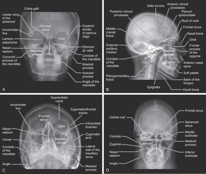 Skull Xray Anatomy Labeled