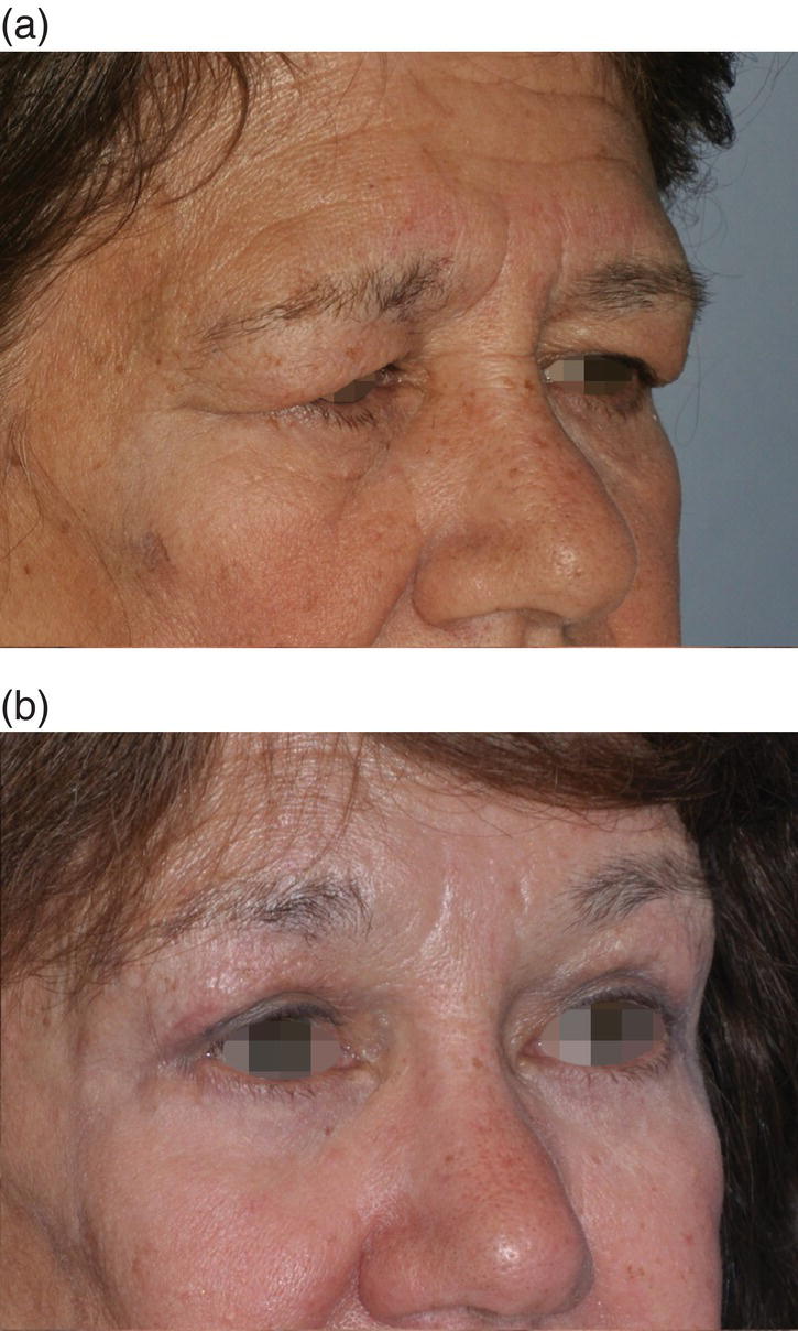 Image described by caption.