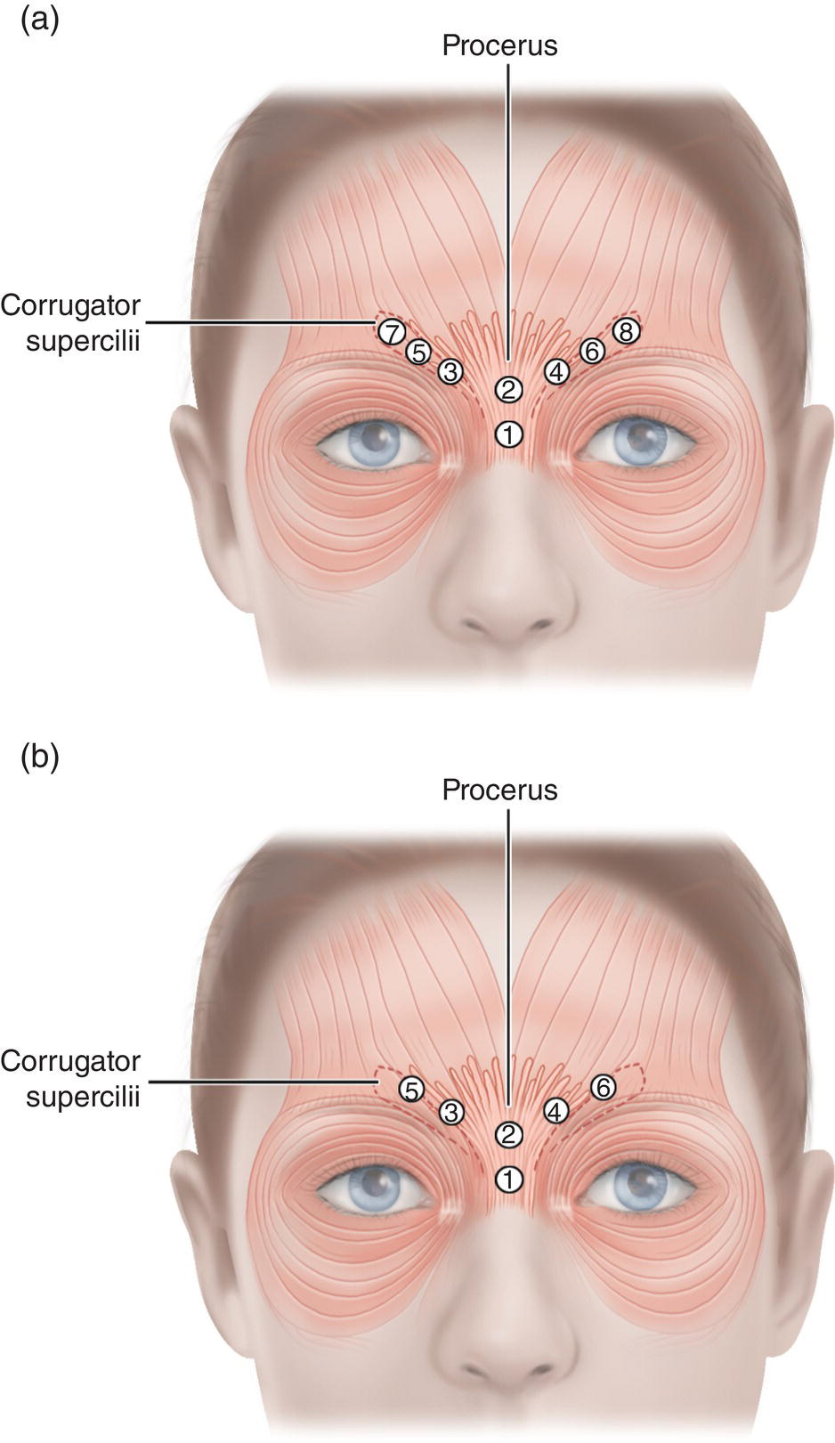 Image described by caption.