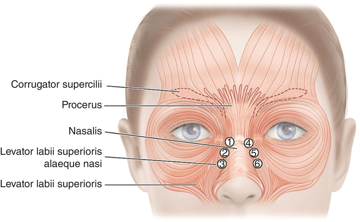 Image described by caption.