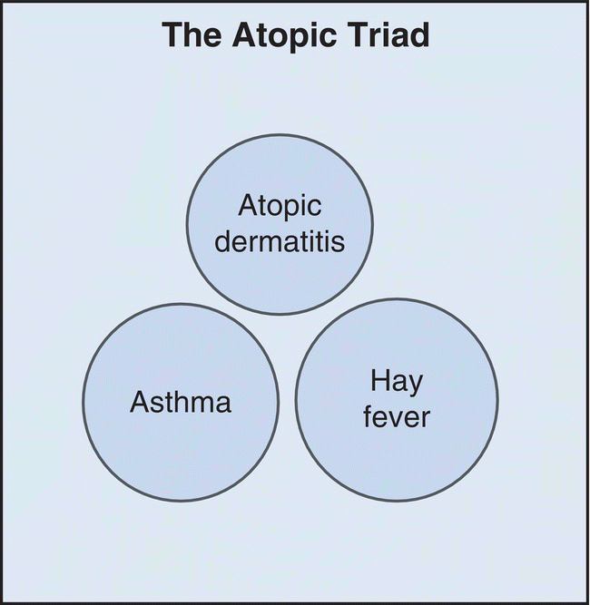 Diagram illustrating the atopic triad depicted by 3 circles labeled Atopic dermatitis (top), Asthma (bottom left), and Hay fever (bottom right).