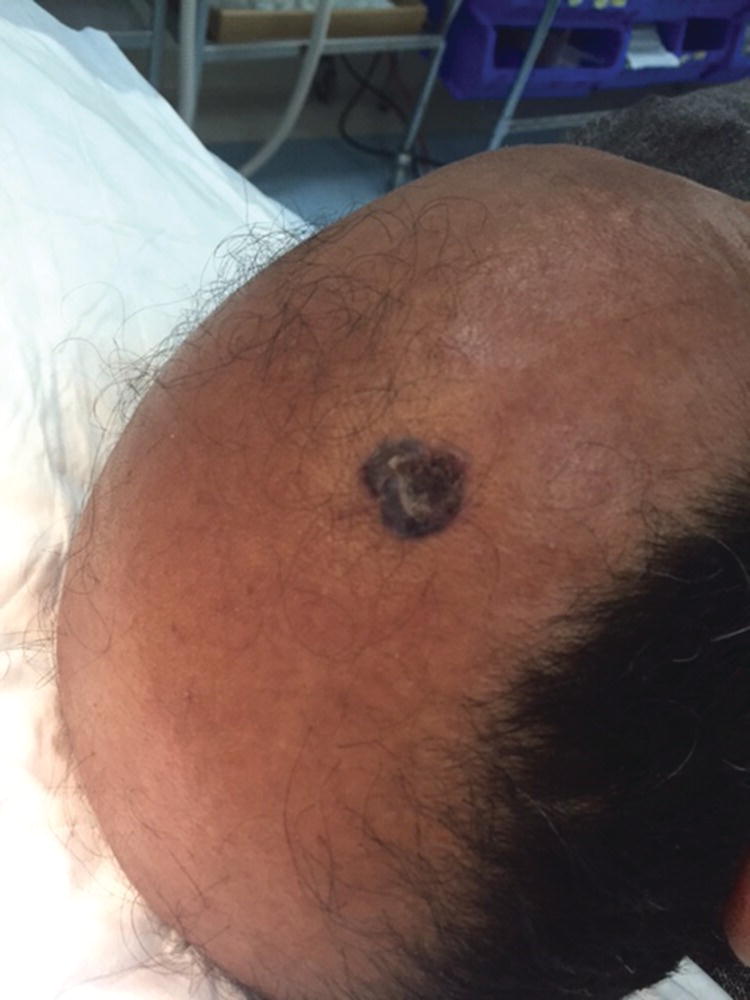 Image described by caption.