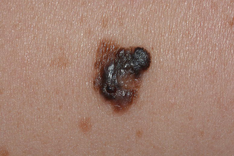 Image described by caption.