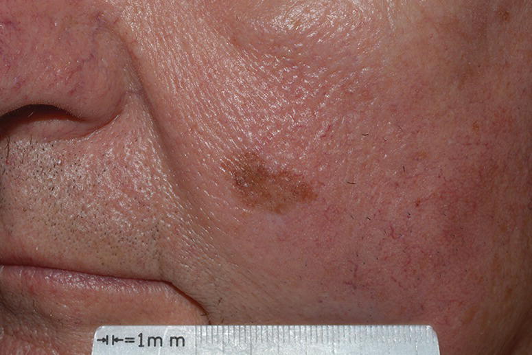 Image described by caption.