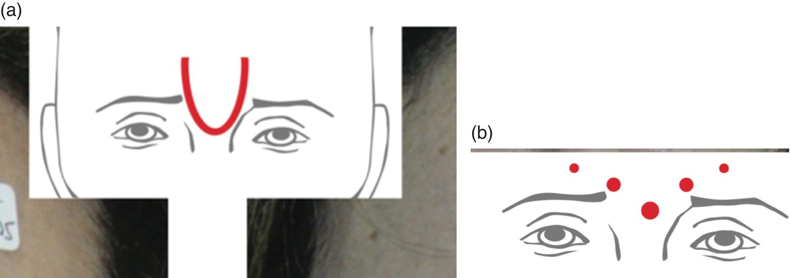 Image described by caption and surrounding text.