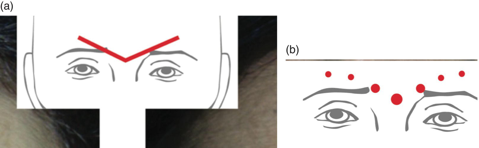 Image described by caption and surrounding text.