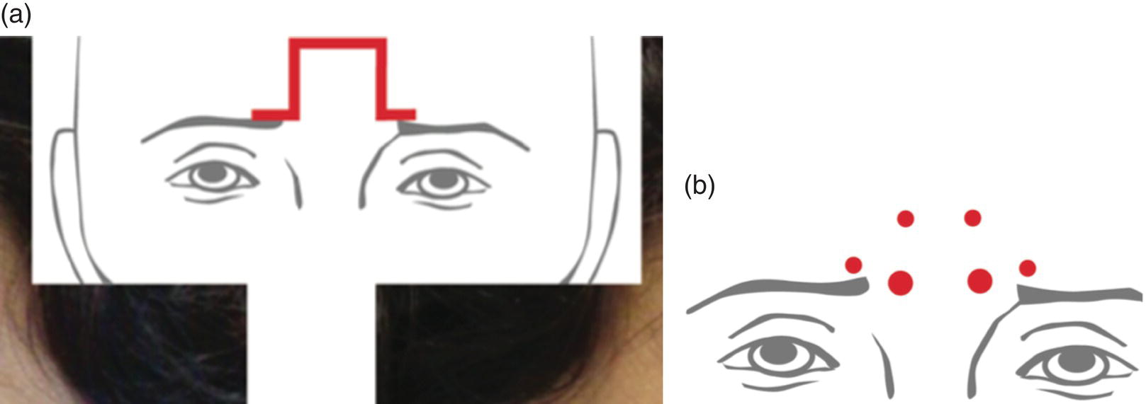 Image described by caption and surrounding text.