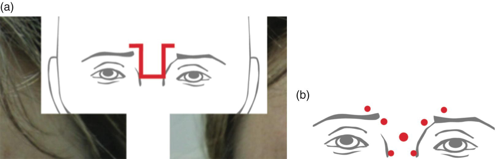 Image described by caption and surrounding text.