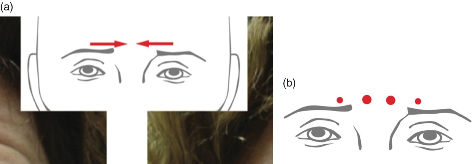 Image described by caption and surrounding text.