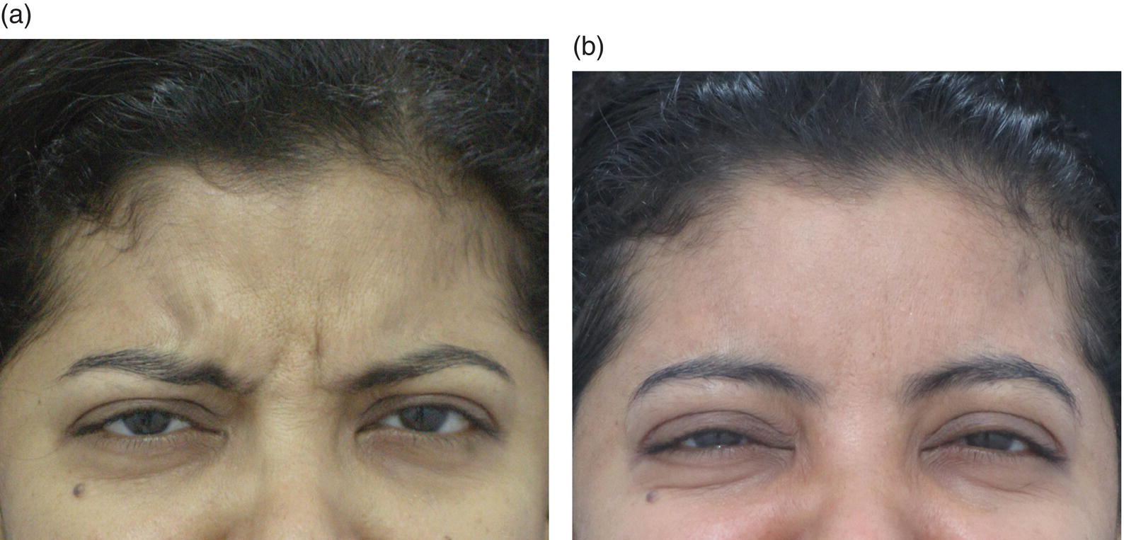 Image described by caption.