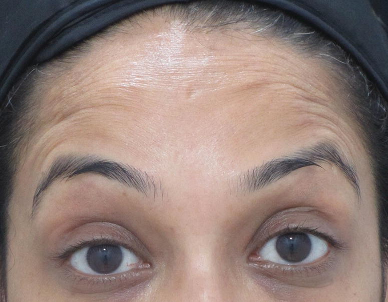 Image described by caption.