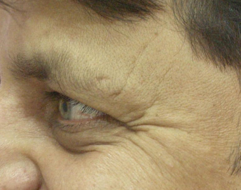 Image described by caption and surrounding text.