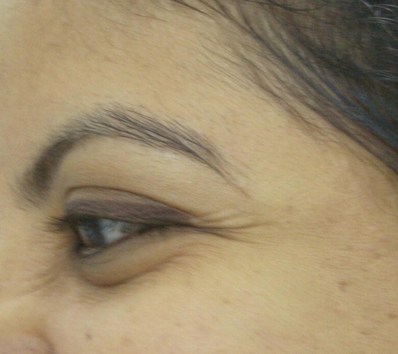 Image described by caption and surrounding text.