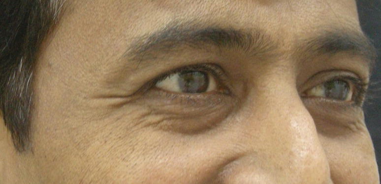 Image described by caption and surrounding text.