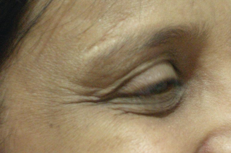 Image described by caption and surrounding text.