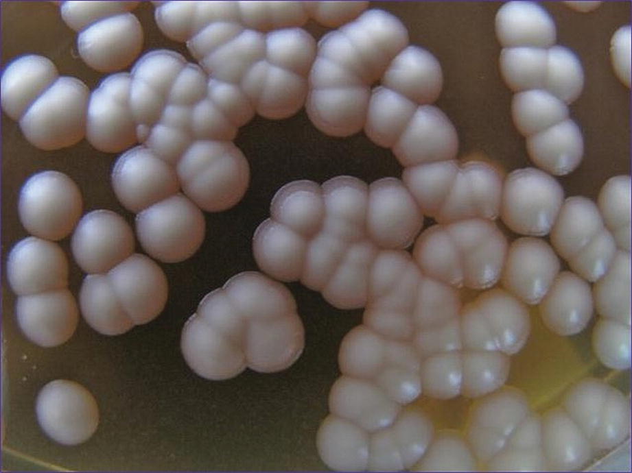 ../images/440271_1_En_12_Chapter/440271_1_En_12_Fig2_HTML.jpg