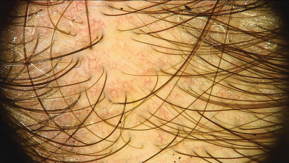 ../images/440271_1_En_12_Chapter/440271_1_En_12_Fig3_HTML.jpg