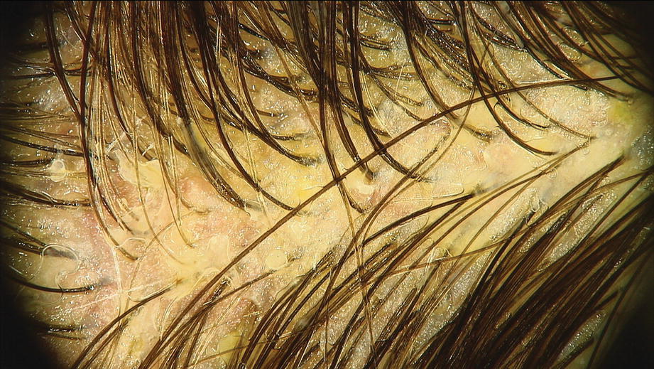 ../images/440271_1_En_12_Chapter/440271_1_En_12_Fig4_HTML.jpg