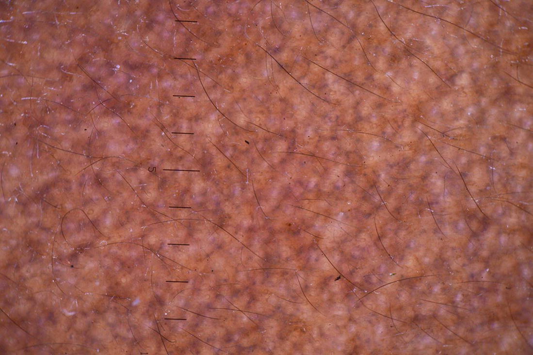 ../images/471276_1_En_7_Chapter/471276_1_En_7_Fig2_HTML.jpg