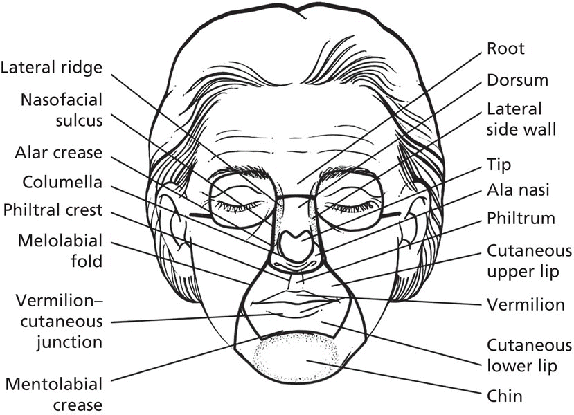 Diagram of the a human face with lines indicating the Lateral ridge, nasofacial sulcus, alar crease, columella, philtral crest, melolabial fold, vermilion-cutaneous junction, mentolabial crease, etc.
