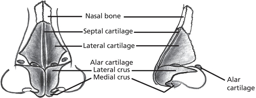 Diagram displaying the front and lateral views of the nasal cartilage with lines marking the nasal bone, septal cartilage, lateral cartilage, lateral crus, medial crus, and alar cartilage.
