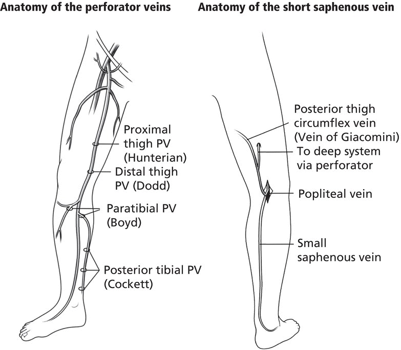 Left: Anatomy of the perforator veins with lines marking the proximal thigh PV, distal thigh PV, etc. Right: Anatomy of the short saphenous vein with lines marking the small saphenous vein, popliteal vein, etc.