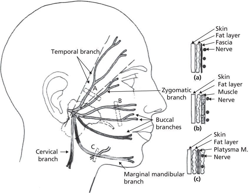 Diagram displaying the lateral view of a human head with parts of temporal, zygomatic, buccal, and marginal mandibular branches enclosed by a box. At the right are magnified views (detailed) of the enclosed parts.