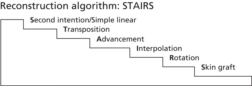 Schematic displaying a stair step with steps labeled skin graft, rotation, interpolation, advancement, transposition, and second intention/simple linear (bottom–top).