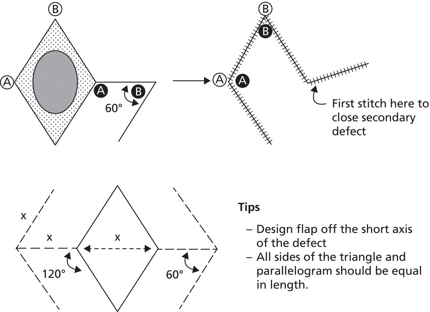 Schematic displaying a rhombus containing an oval, with an angle of 60° from a horizontal line (linked to the rhombus) and an oblique line (top) and a rhombus with horizontal lines connected to 2 V-shaped lines (bottom).