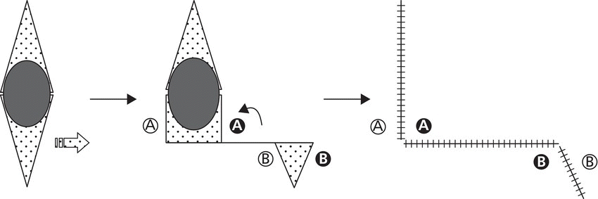 Schematic depicting Burow’s advancement flap: unilateral advancement, with arrows linking a diamond containing an ellipse, an irregular shape with an ellipse, and an L-shape with hatched lines.