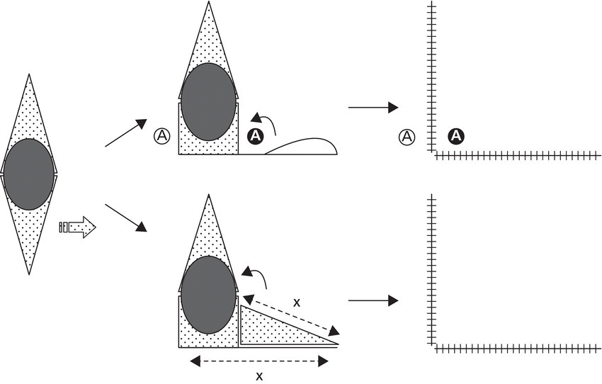Schematic depicting a modified crescentic advancement flap: unilateral advancement, with arrows linking from a diamond shape with ellipse to 2 irregular shapes with ellipses, then to 2 L shapes with hatched lines.