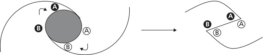 Schematic illustrating the process of O–Z plasty/bilateral rotation flap.