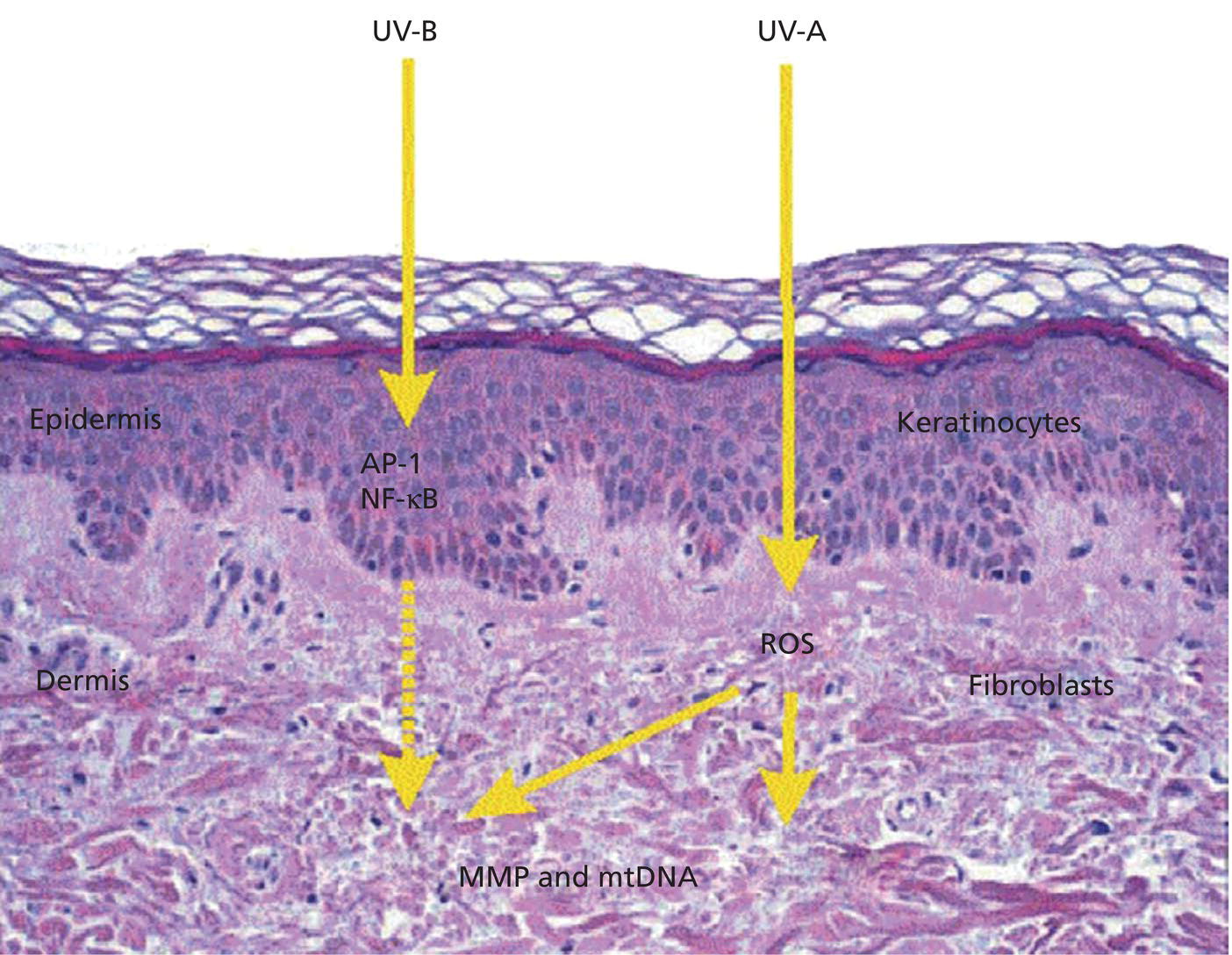Schematic illustration of ultraviolet light interacts with different skin cells at different depths.