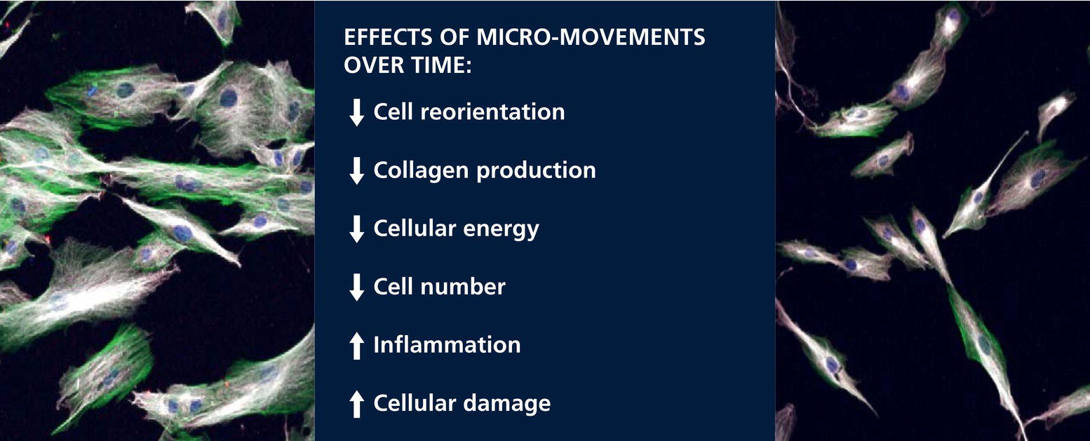 Schematic illustration of in vitro model of eye skin aging. Comparison between immunostained cells from a 19-year-old (left) and 62-year-old (right) that were imaged using confocal microscopy.